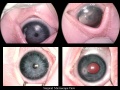 Thumbnail for version as of 11:36, April 12, 2012