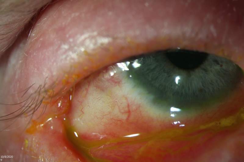 File:Dup anky eyewiki.png