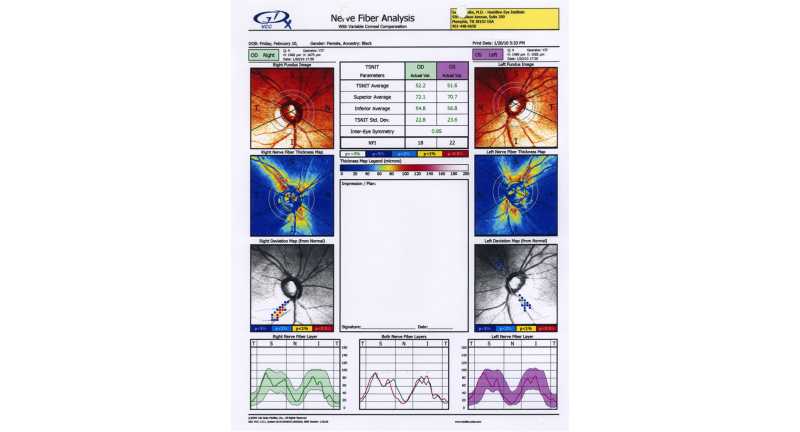 File:GDx.png