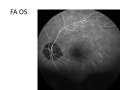 Thumbnail for version as of 11:56, June 17, 2012