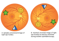 Thumbnail for version as of 13:15, June 16, 2023