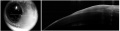 Thumbnail for version as of 01:36, December 2, 2015