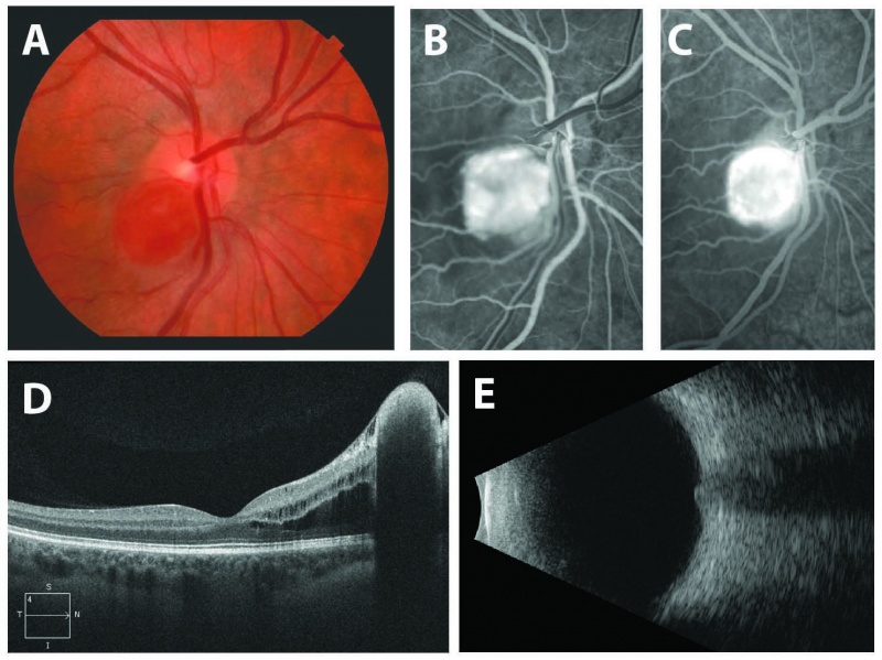 File:VHL Fig3.jpg