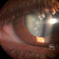 Thumbnail for version as of 09:47, May 8, 2023