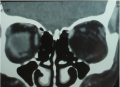 Thumbnail for version as of 04:47, June 1, 2021