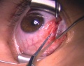 Thumbnail for version as of 12:07, June 28, 2010