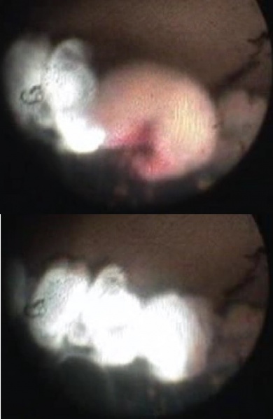File:ECP.CP.shrinkage.jpg