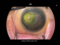 Thumbnail for version as of 11:00, April 12, 2012