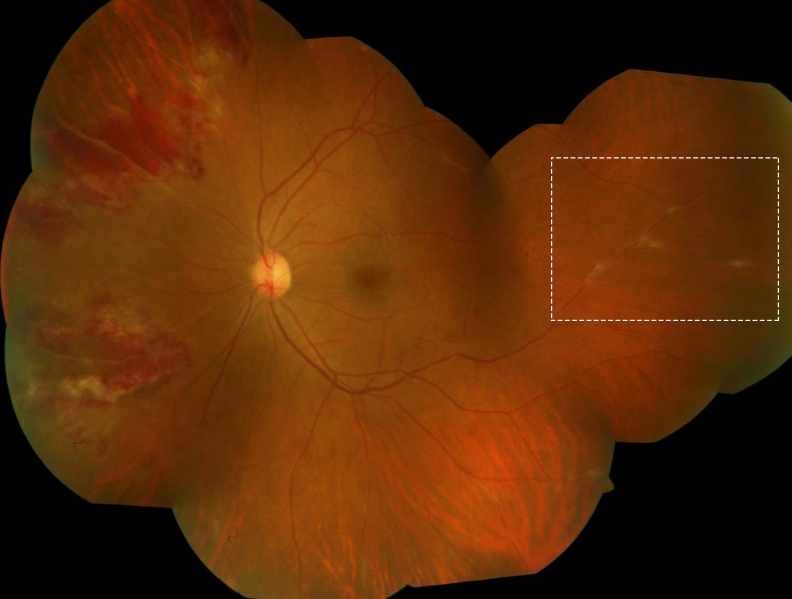 File:Figure cmv.jpg