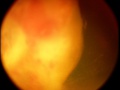 Thumbnail for version as of 18:32, November 15, 2019