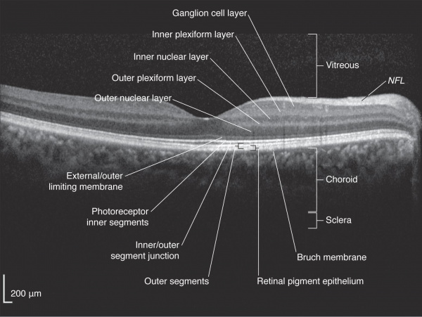 Use of OCT in Neurodegenerative Diseases - EyeWiki