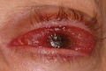 Thumbnail for version as of 06:40, May 14, 2011