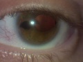 Thumbnail for version as of 13:18, August 13, 2011