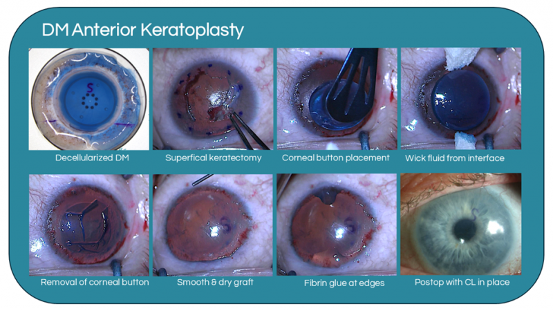 File:Surgical Technique.png