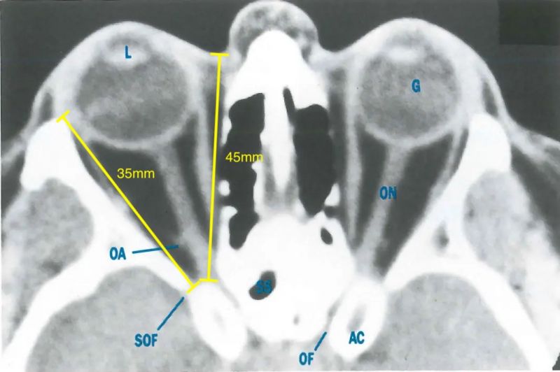 File:Midglobe copy.jpg