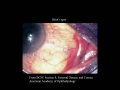 Thumbnail for version as of 11:27, April 12, 2012