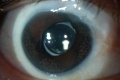 Thumbnail for version as of 09:54, June 5, 2012