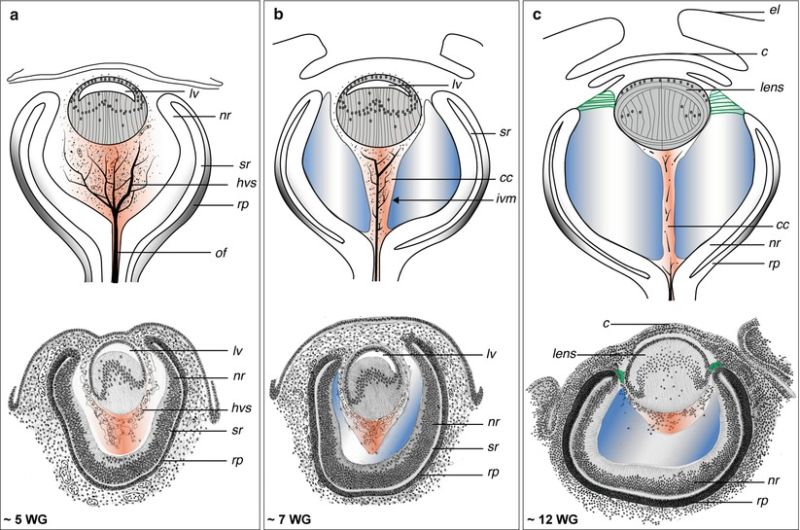 File:Vitreous embryology.jpg