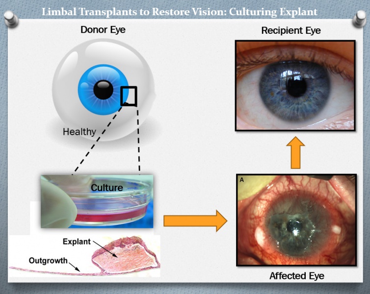 File:Limbal Explant Culture.jpg