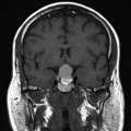 Thumbnail for version as of 09:00, April 29, 2012