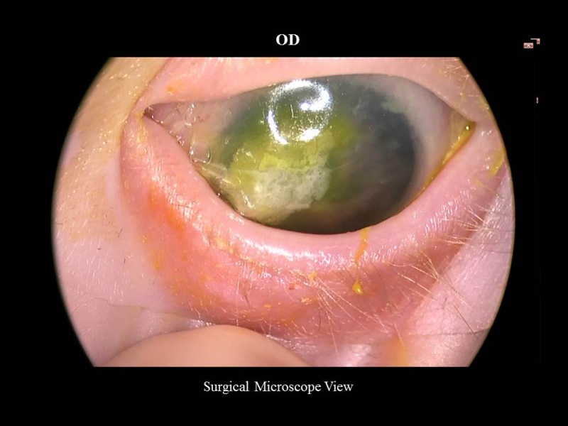 File:MHDSlide21.JPG