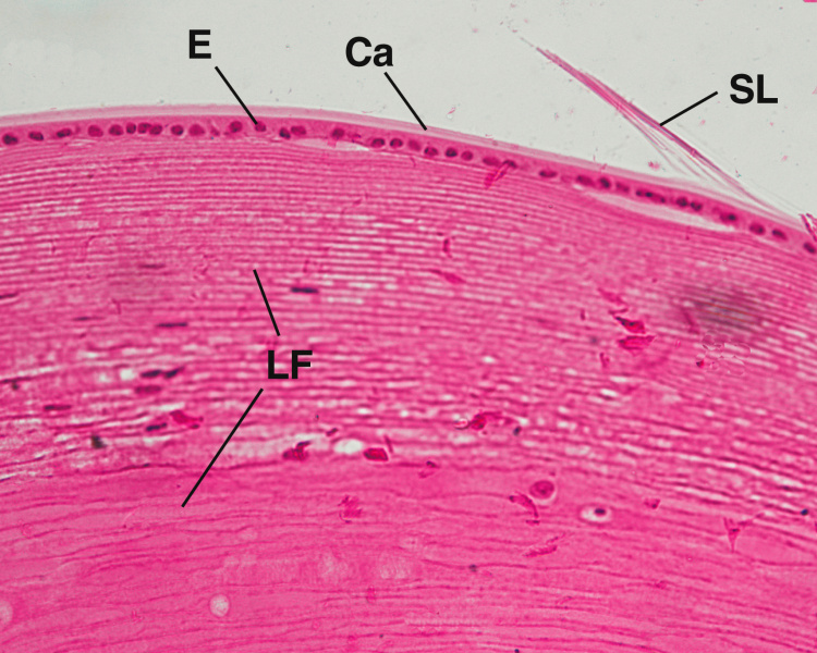 File:Lens Gartner.jpg