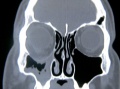 Thumbnail for version as of 22:36, November 29, 2013