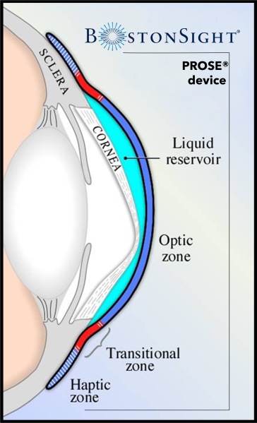File:PROSE Device Layout Vertical.png