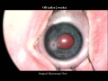 Thumbnail for version as of 11:35, April 12, 2012