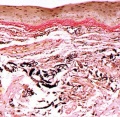 Thumbnail for version as of 14:42, March 2, 2014