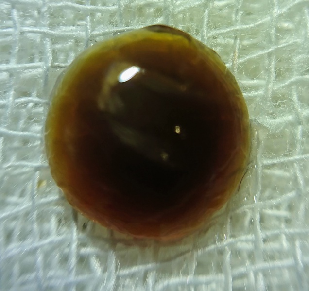 File:Brown nucleus .jpeg