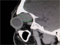 Thumbnail for version as of 19:59, October 20, 2013