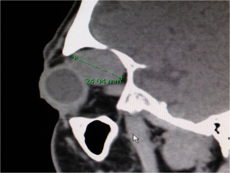File:CT PALG Figure 4.jpg
