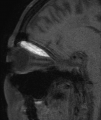 Thumbnail for version as of 00:02, February 10, 2016